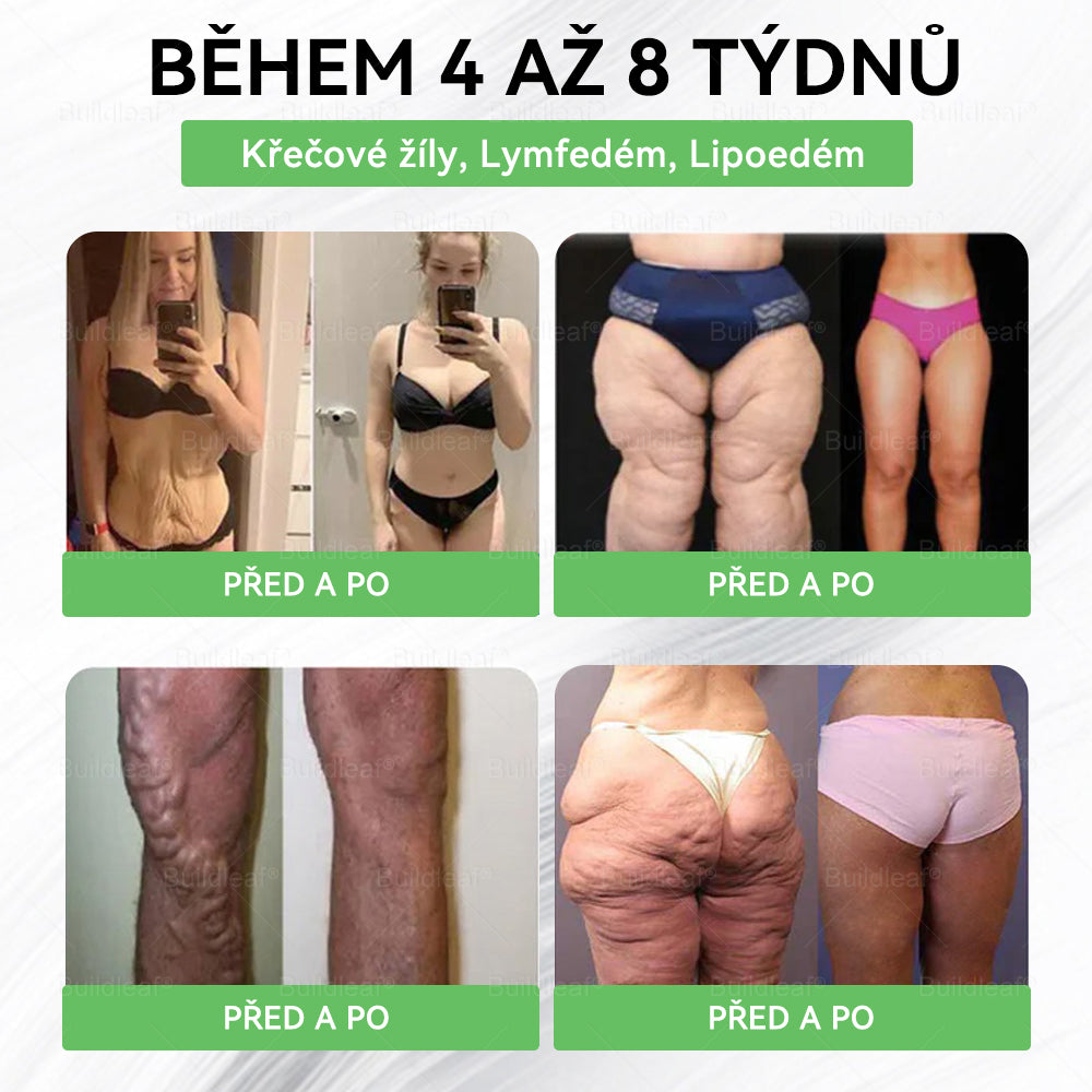 🏆️Oficiální obchod ČR | BuildLeaf® GLP-1 8-v-1 Fit & Vital Řešení (Jednou denně, viditelné změny za 7 dní) ✅ Obezita, kardiovaskulární zdraví, cukrovka, spánková apnoe, zdraví střev, problémy se klouby a další.